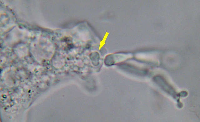 Mayorella with fungus