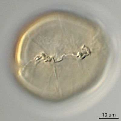 Microcorycia spec.