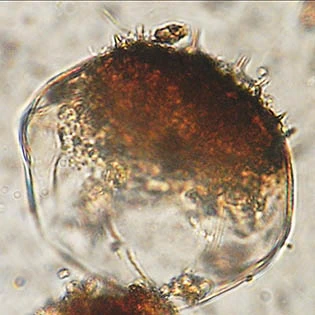 Microcorycia aculeata