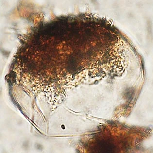 Microcorycia aculeata