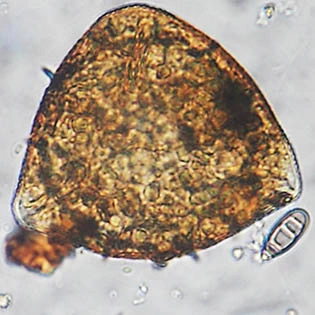 Microcorycia aculeata