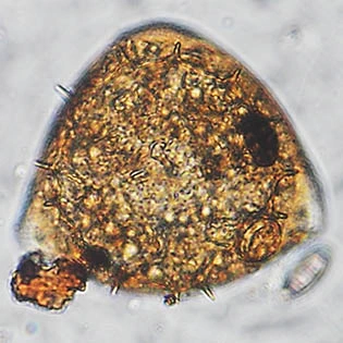 Microcorycia aculeata