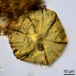 Microcorycia fysalis