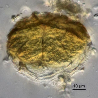 Microcorycia fysalis