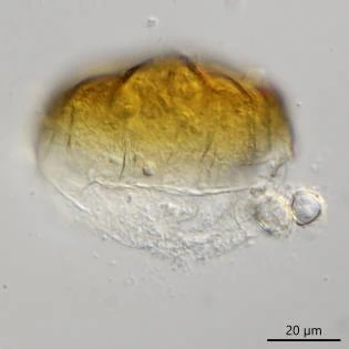 Microcorycia fysalis