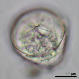 Microcorycia radiata