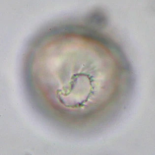 Microcorycia radiata