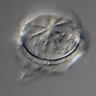 Microcorycia radiata