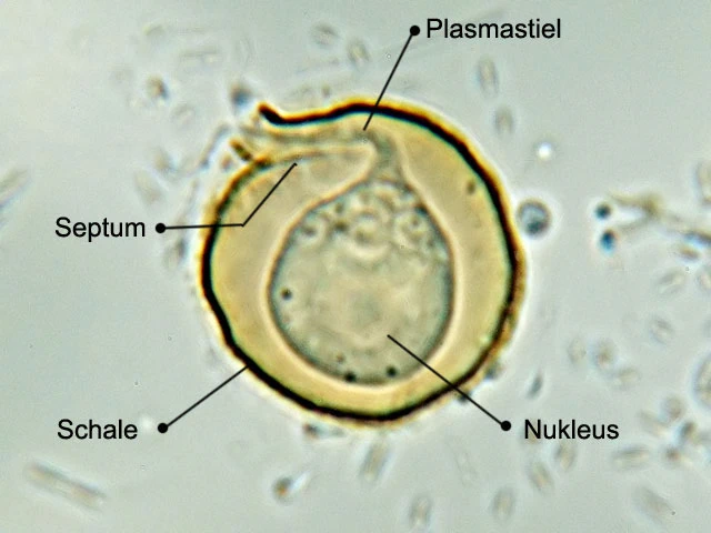 Microgromia haeckeliana