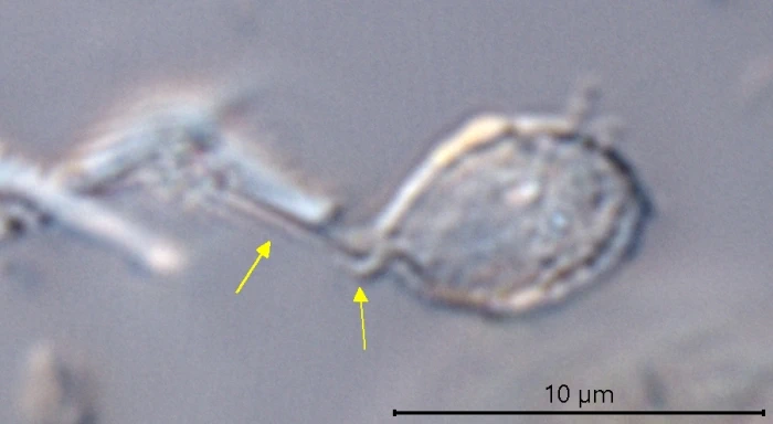Micropyxidiella