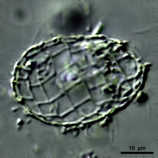 Microquadrula spec.