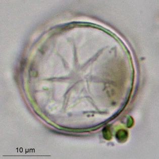 Microcorycia radiata