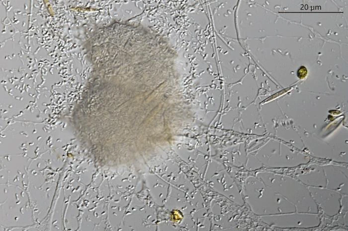 Reticulomyxa filosa