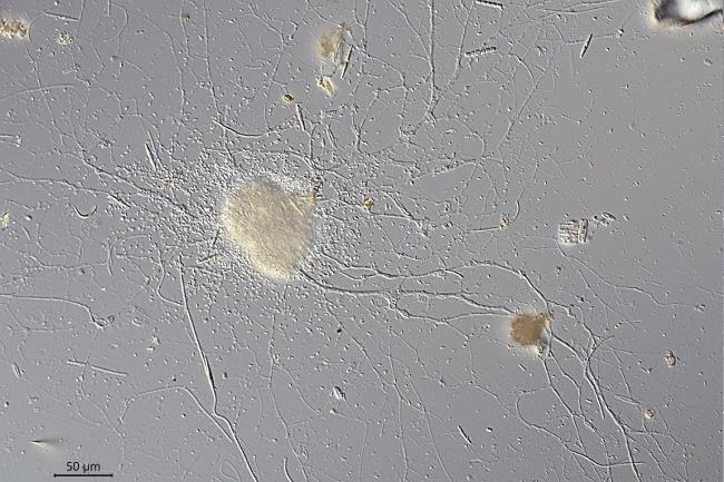 Reticulomyxa filosa