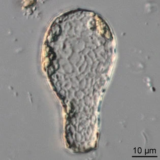 Padaungiella tubulata