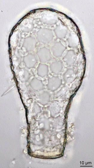 Padaungiella lageniformis