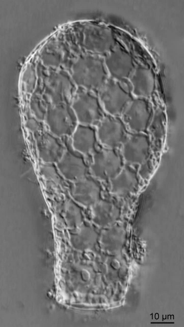 Padaungiella lageniformis