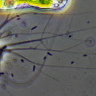 Nuclearia thermophila