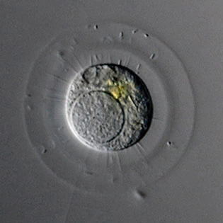 Nuclearia radians - Ferry Siemensma