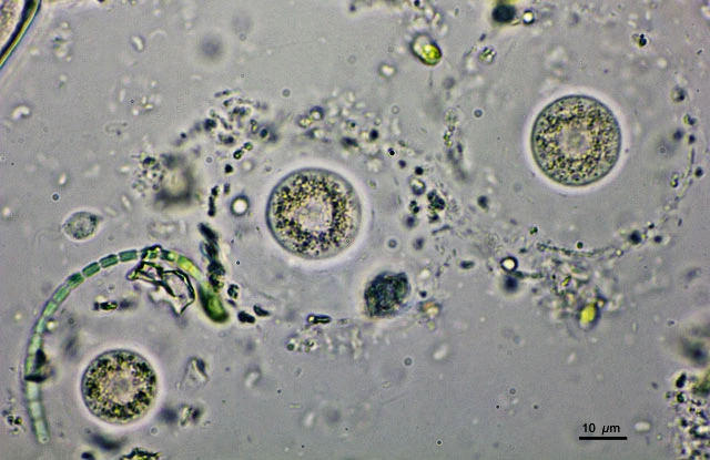 Nuclearia thermophila