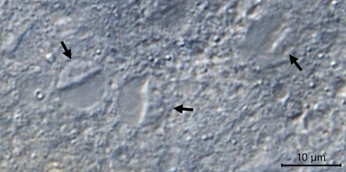 Claparedellus lachmannii