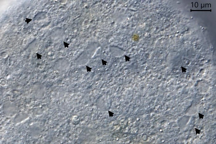 Claparedellus lachmannii