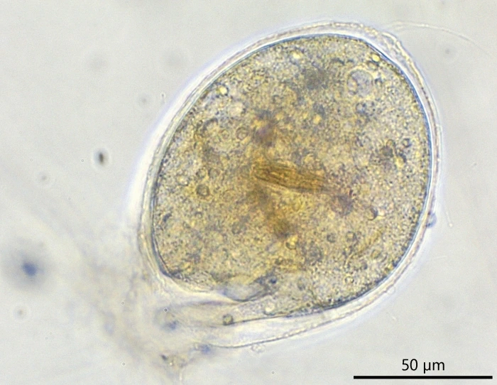 freshwater foraminifer