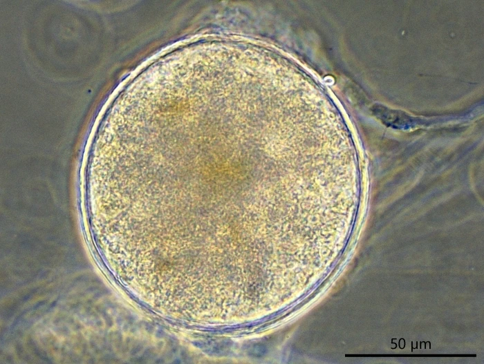 freshwater foraminifer