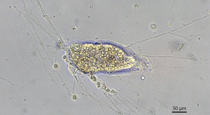 freshwater foraminifer