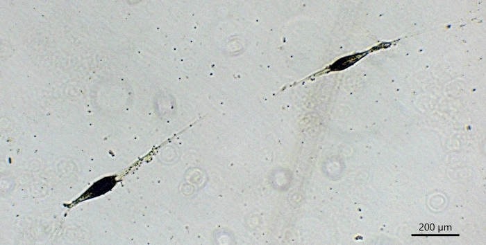 freshwater foraminifer