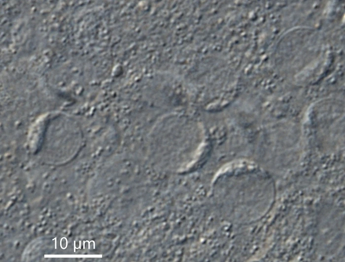 freshwater foraminifer