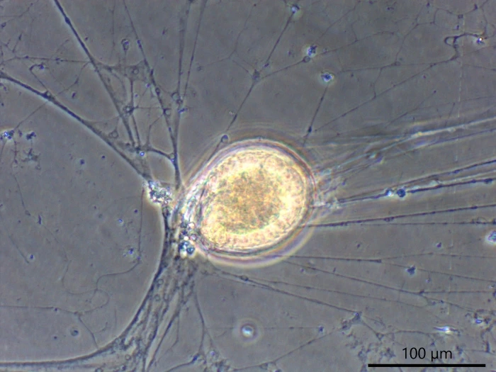 freshwater foraminifer