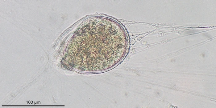 freshwater foraminifer