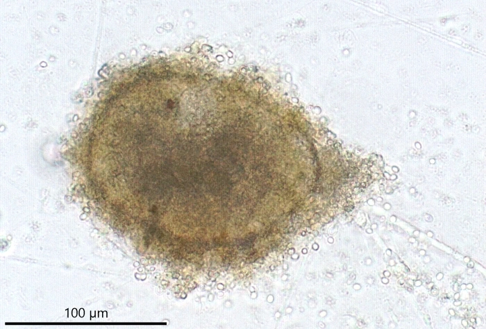 freshwater foraminifer