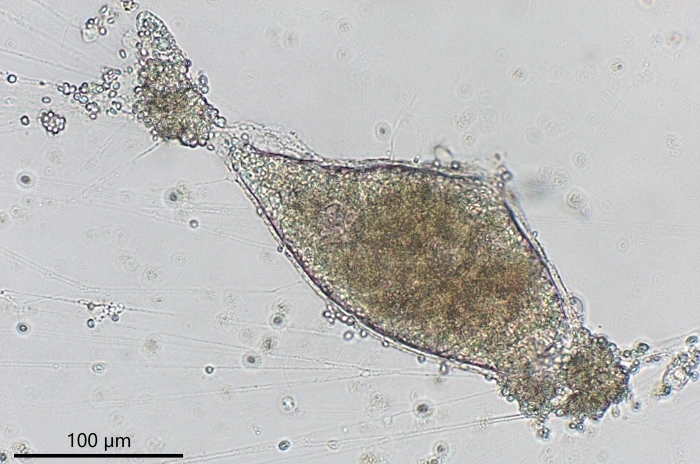 freshwater foraminifer