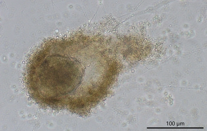 freshwater foraminifer