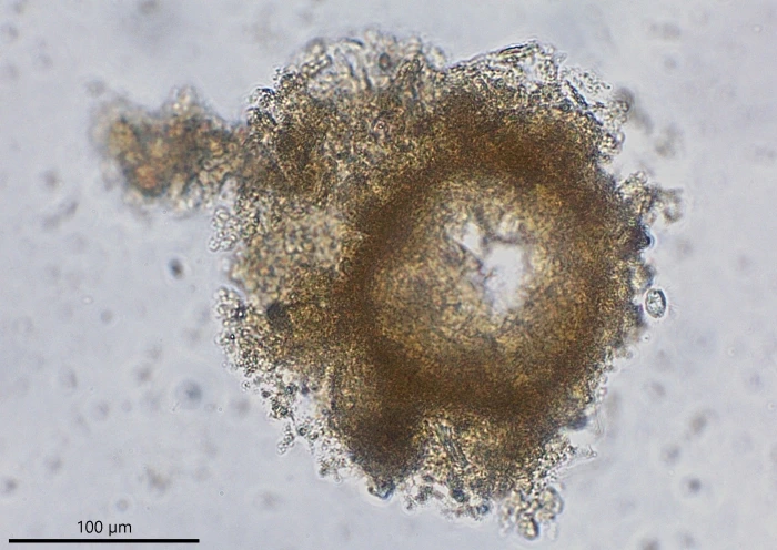 freshwater foraminifer