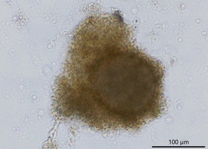 freshwater foraminifer