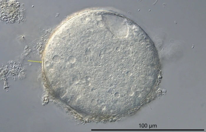 freshwater foraminifer