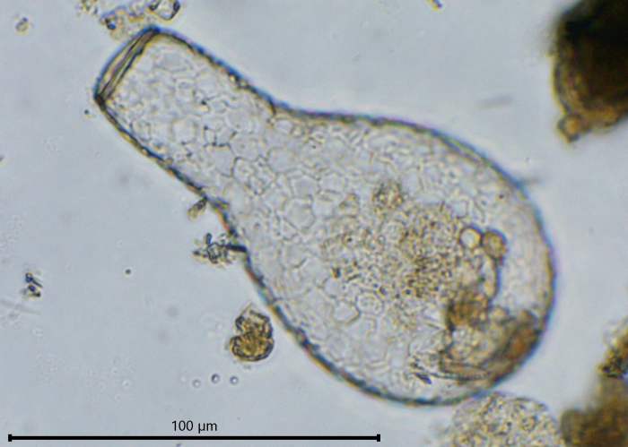 Padaungiella lageniformis