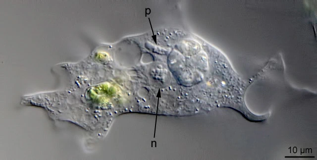 Paramoeba