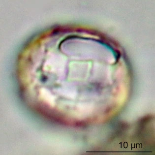 Paraquadrula irregularis