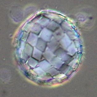 Paraquadrula irregularis
