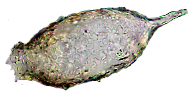 Pareuglypha reticulata