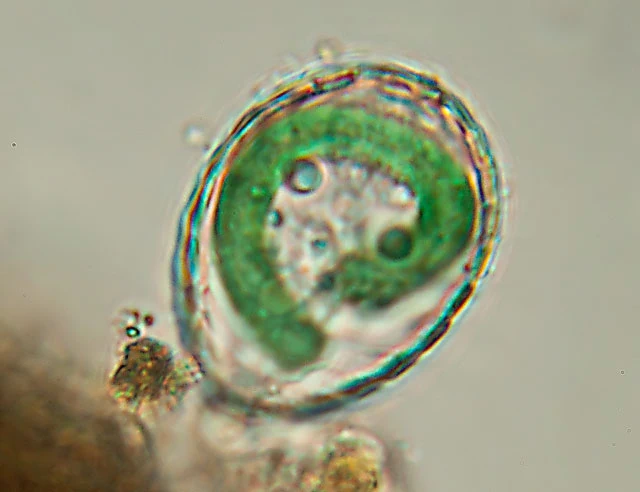 Paulinella chromatophora