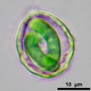 Paulinella chromatophora