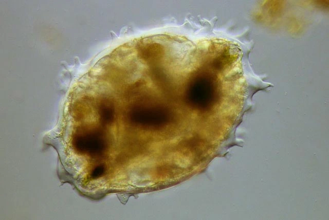 Pelomyxa corona