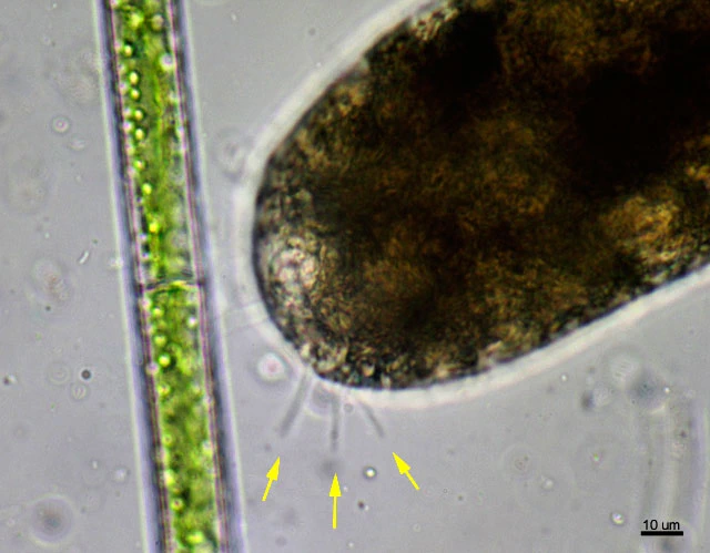 Pelomyxa gruberi