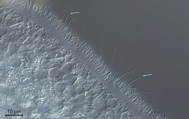 Pelomyxa palustris