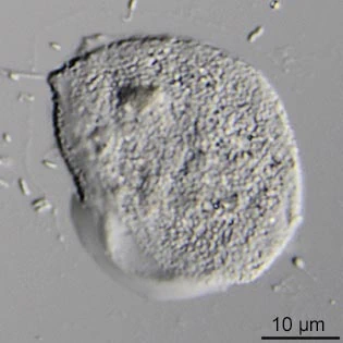 Thaumatomonas